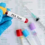 PSA Waarde Test is een bloedonderzoek in een laboratorium naar deze eiwit waarde van de prostaat