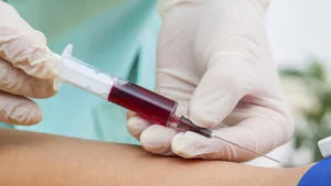 PSA waarde te hoog bepalen gaat middels bloedafname uit de ader in de elleboogplooi