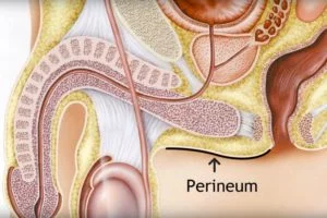 Perineum is het gebied tussen balzak en anus, hier wordt trans perineaal geprikt