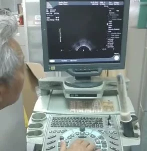arts kijkt naar scherm bladderscan