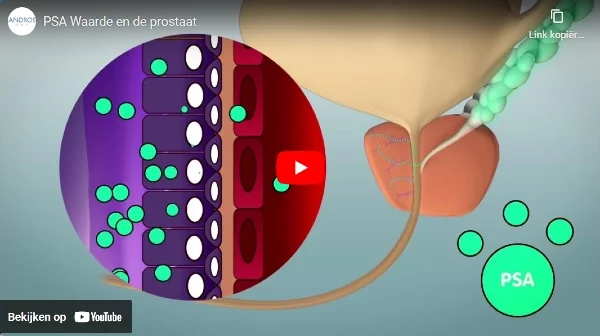 Bekijk video PSA Waarde en Prostaat op YouTube